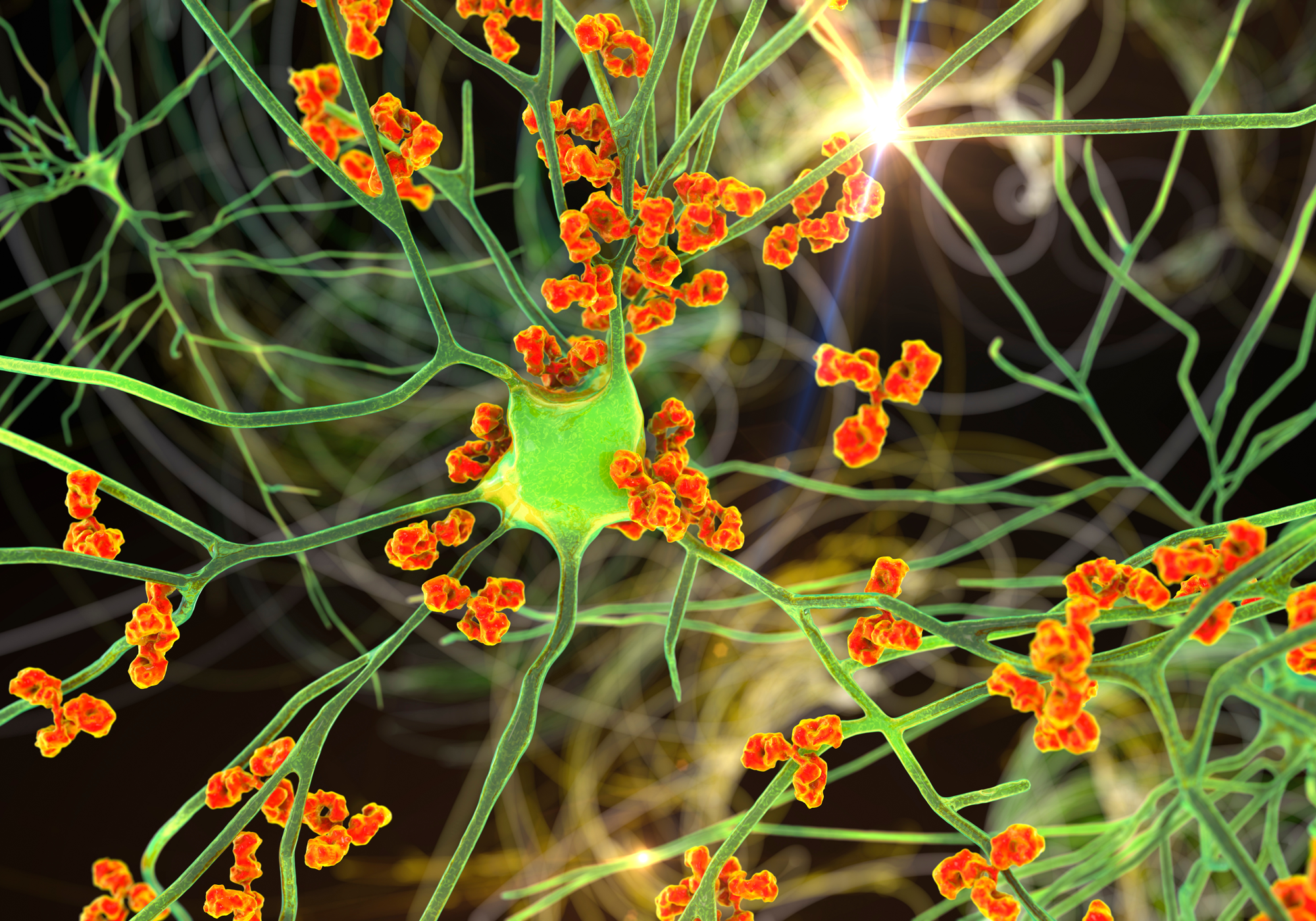 Neuron with orange protrusions on a dark background