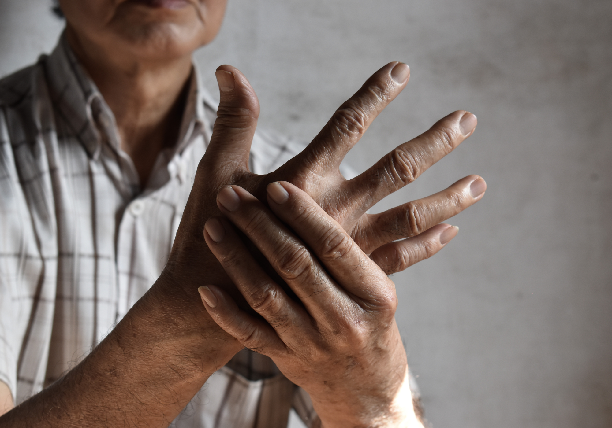 Person holding their hands, showing signs of arthritis on a plain background