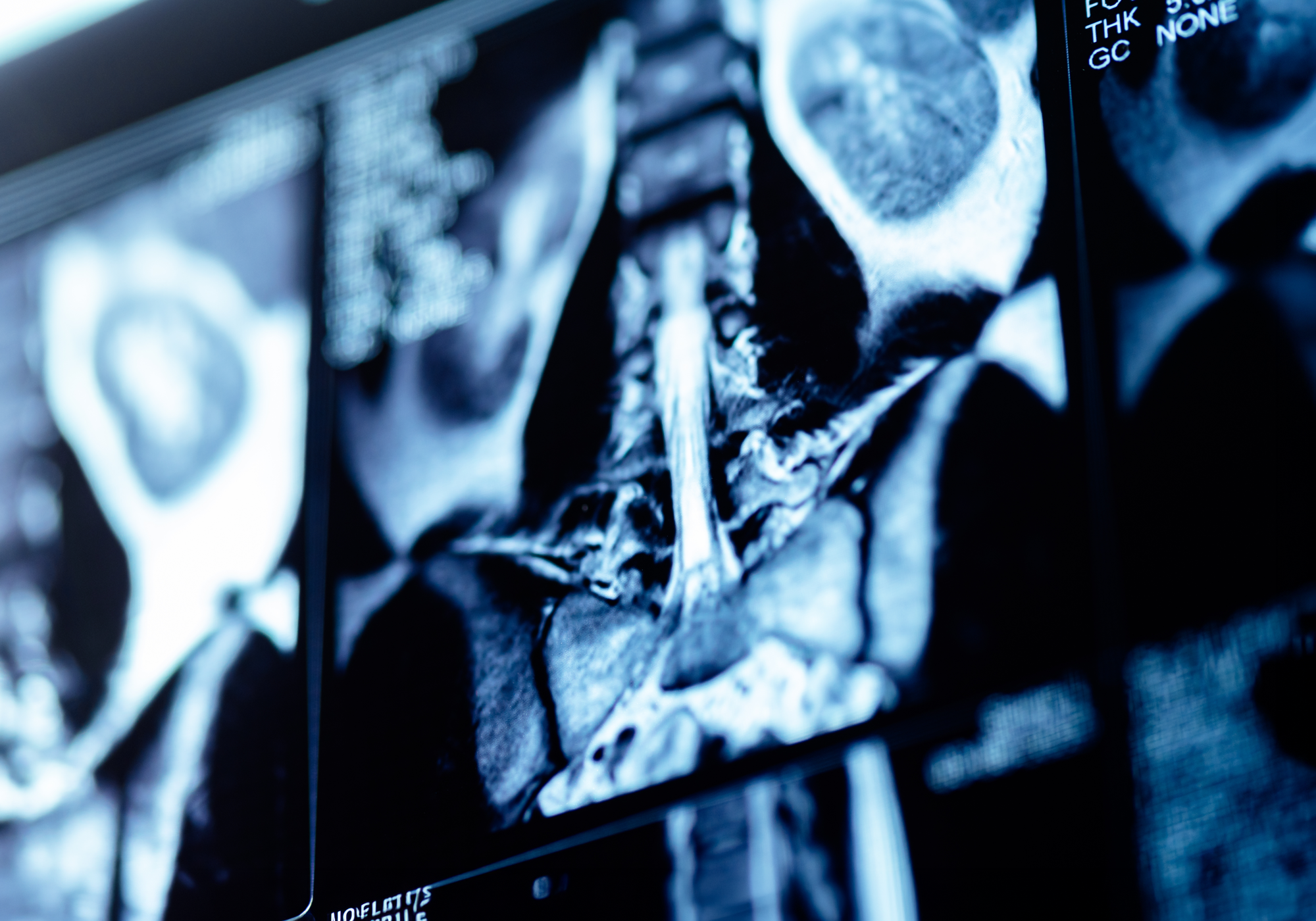 Close-up of an X-ray image on a monitor