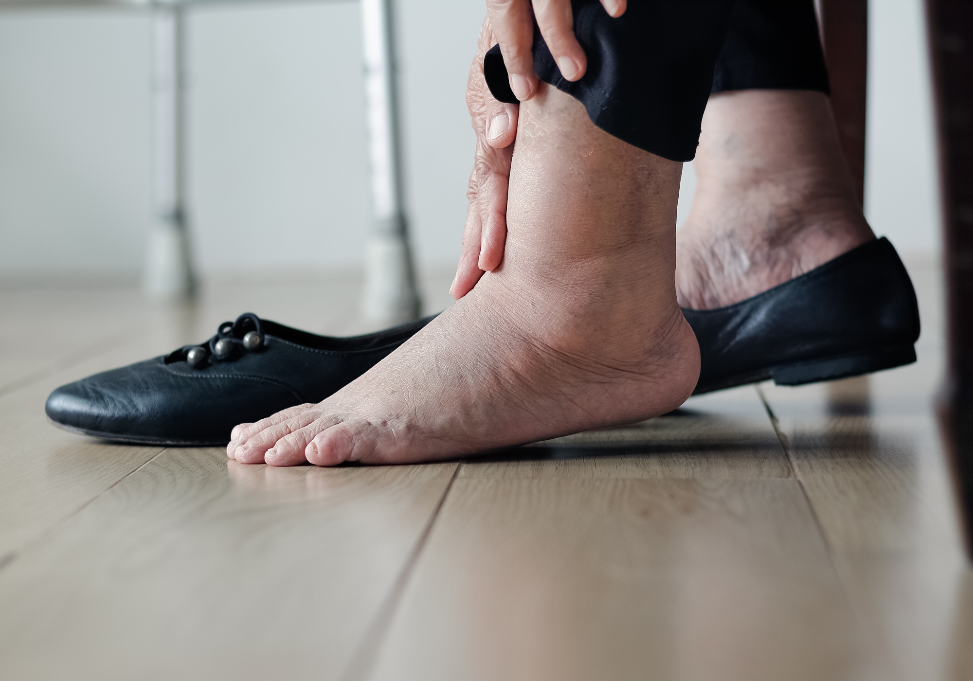 Person wearing black flats with one foot out holding their swollen ankle with a blurred walker in the background